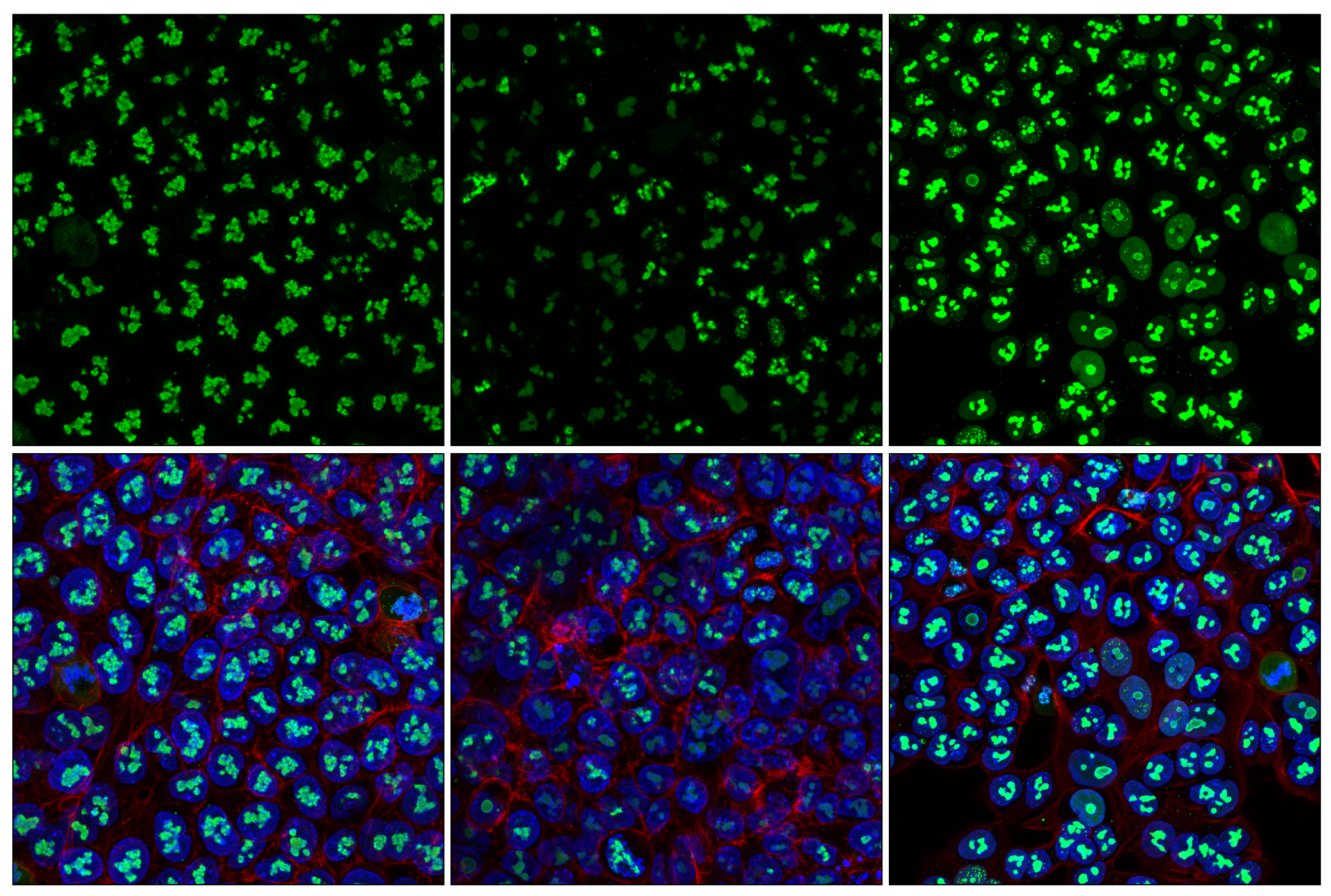 Immunofluorescence Image 1: DDX21 (E9O2Q) Rabbit mAb