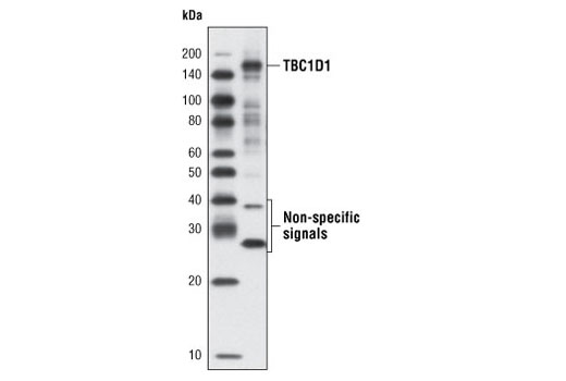 Western Blotting Image 1: TBC1D1 (G689) Antibody