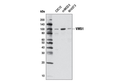 Western Blotting Image 1: VMS1 (D10E6) Rabbit mAb