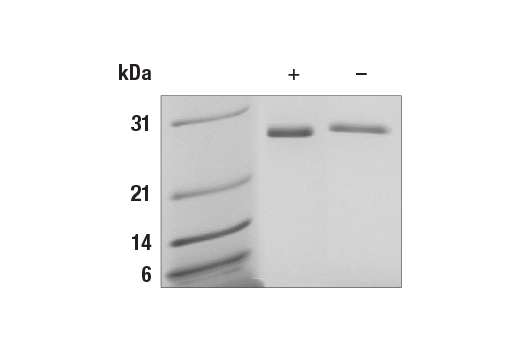  Image 1: Human Galectin-3/LGALS3 Recombinant Protein