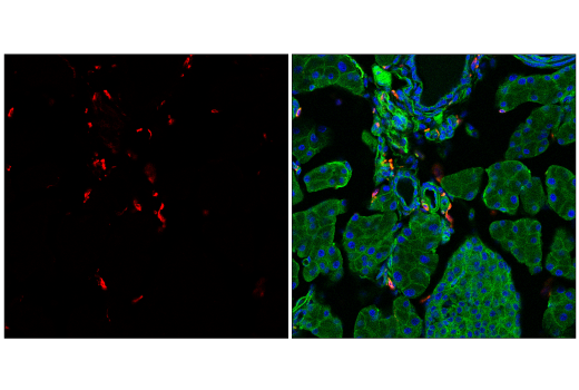 Immunofluorescence Image 2: CD206/MRC1 (E6T5J) XP® Rabbit mAb (Alexa Fluor® 594 Conjugate)