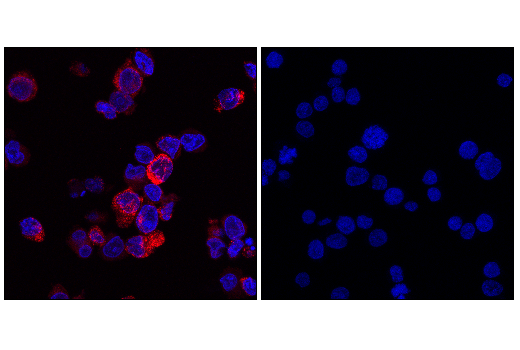 Immunofluorescence Image 4: CD206/MRC1 (E6T5J) XP® Rabbit mAb (Alexa Fluor® 594 Conjugate)