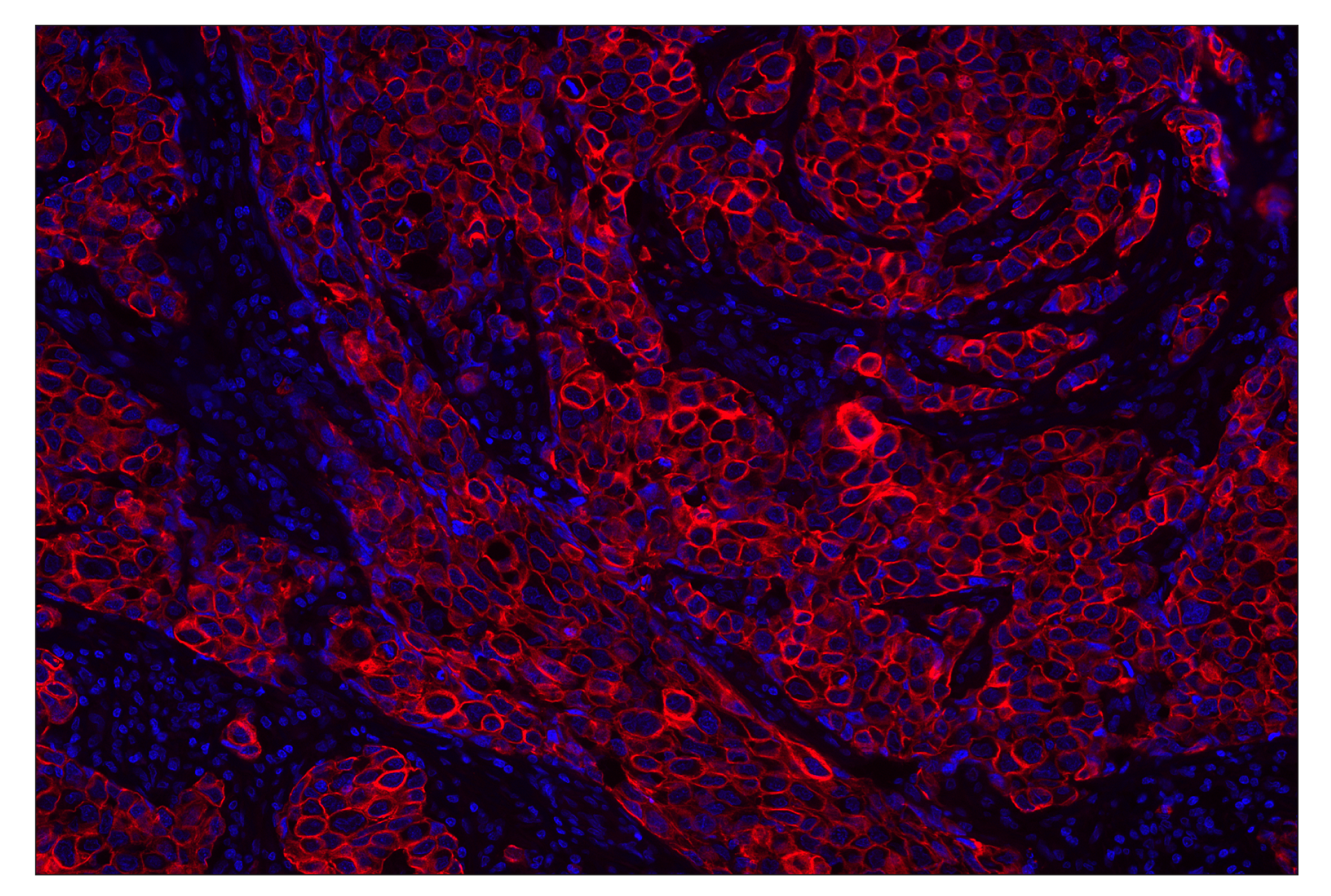 Immunohistochemistry Image 1: Pan-Keratin (Type I) (E6S1S) Rabbit mAb (Alexa Fluor® 555 Conjugate)