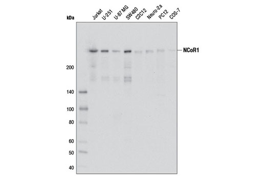 Western Blotting Image 1: NCoR1 Antibody