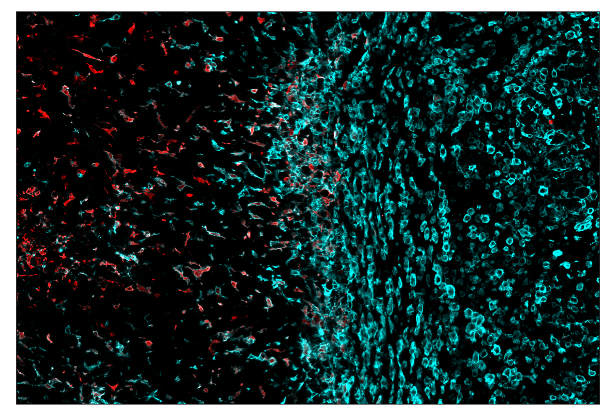 Immunohistochemistry Image 6: Arginase-1 (D4E3M) & CO-0075-594 SignalStar™ Oligo-Antibody Pair