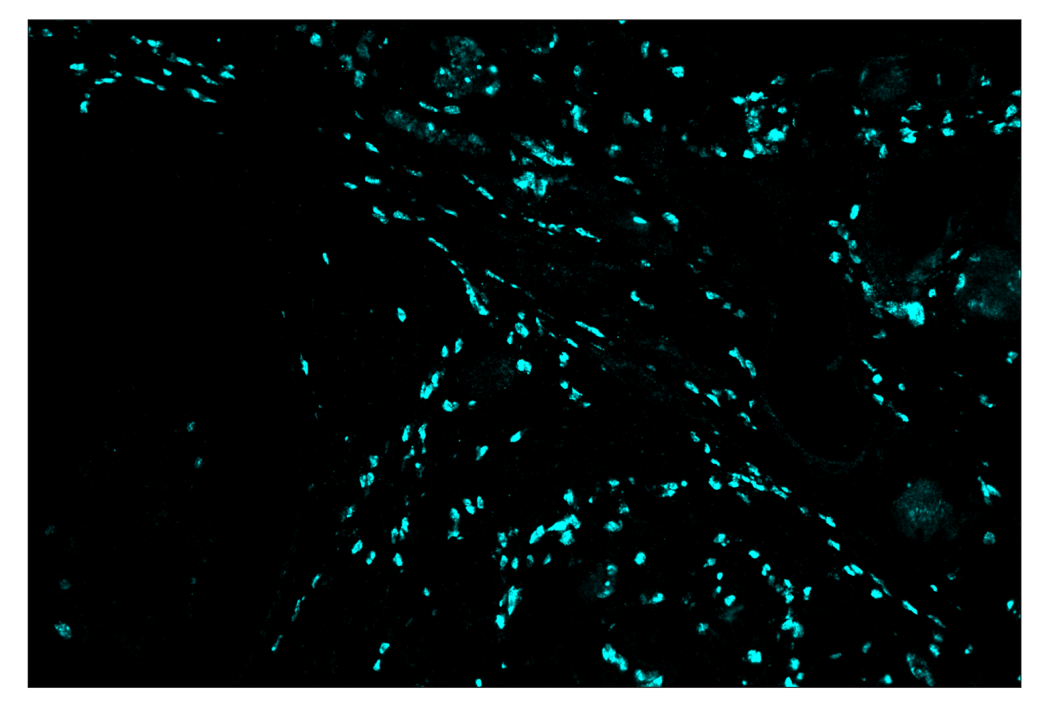 Immunohistochemistry Image 4: Arginase-1 (D4E3M) & CO-0075-488 SignalStar™ Oligo-Antibody Pair