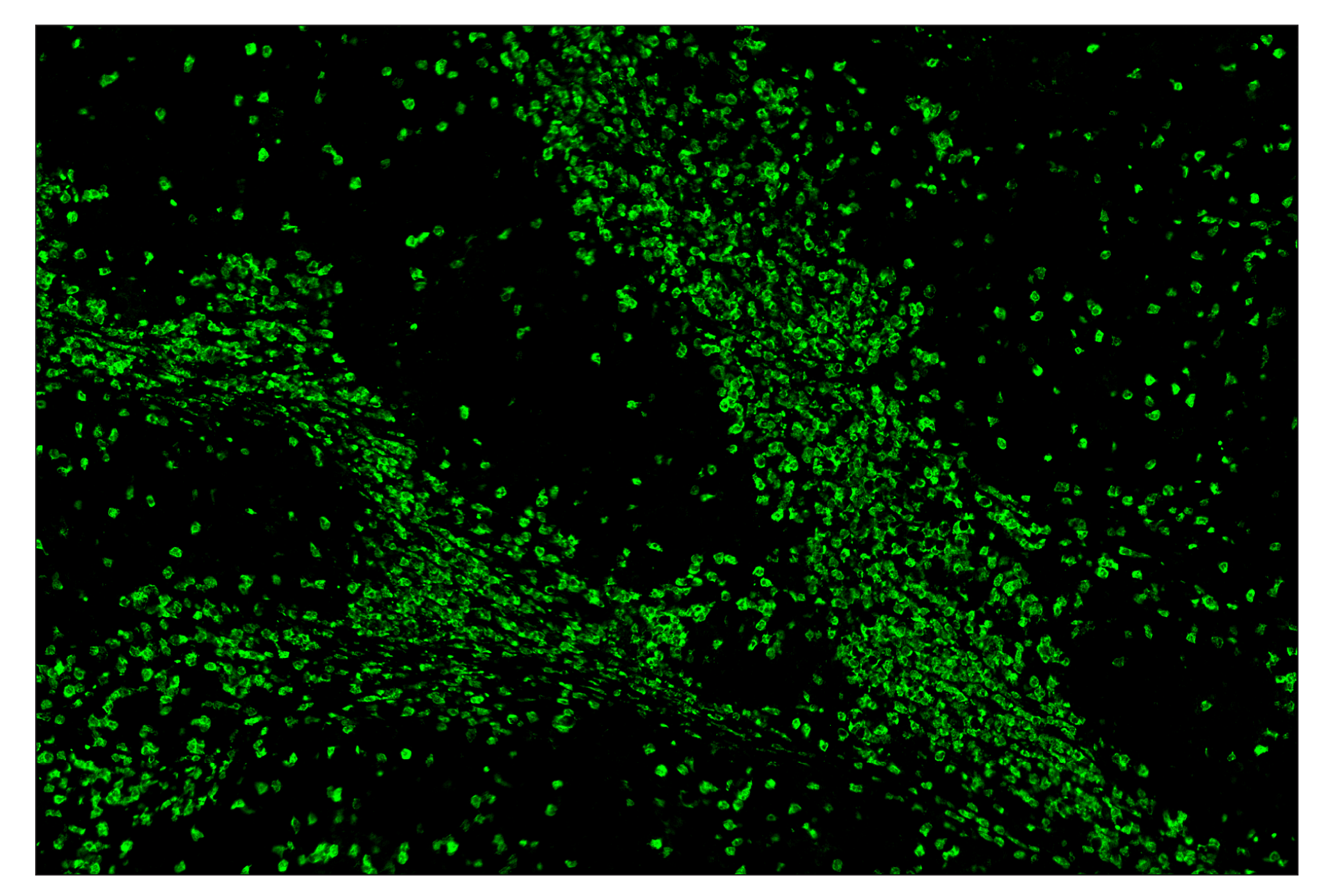 Immunohistochemistry Image 1: Arginase-1 (D4E3M) & CO-0075-594 SignalStar™ Oligo-Antibody Pair