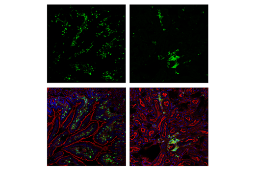 Immunofluorescence Image 1: CD45 (D3F8Q) Rabbit mAb (Alexa Fluor® 488 Conjugate)
