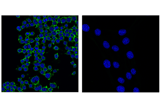 Immunofluorescence Image 2: CD45 (D3F8Q) Rabbit mAb (Alexa Fluor® 488 Conjugate)