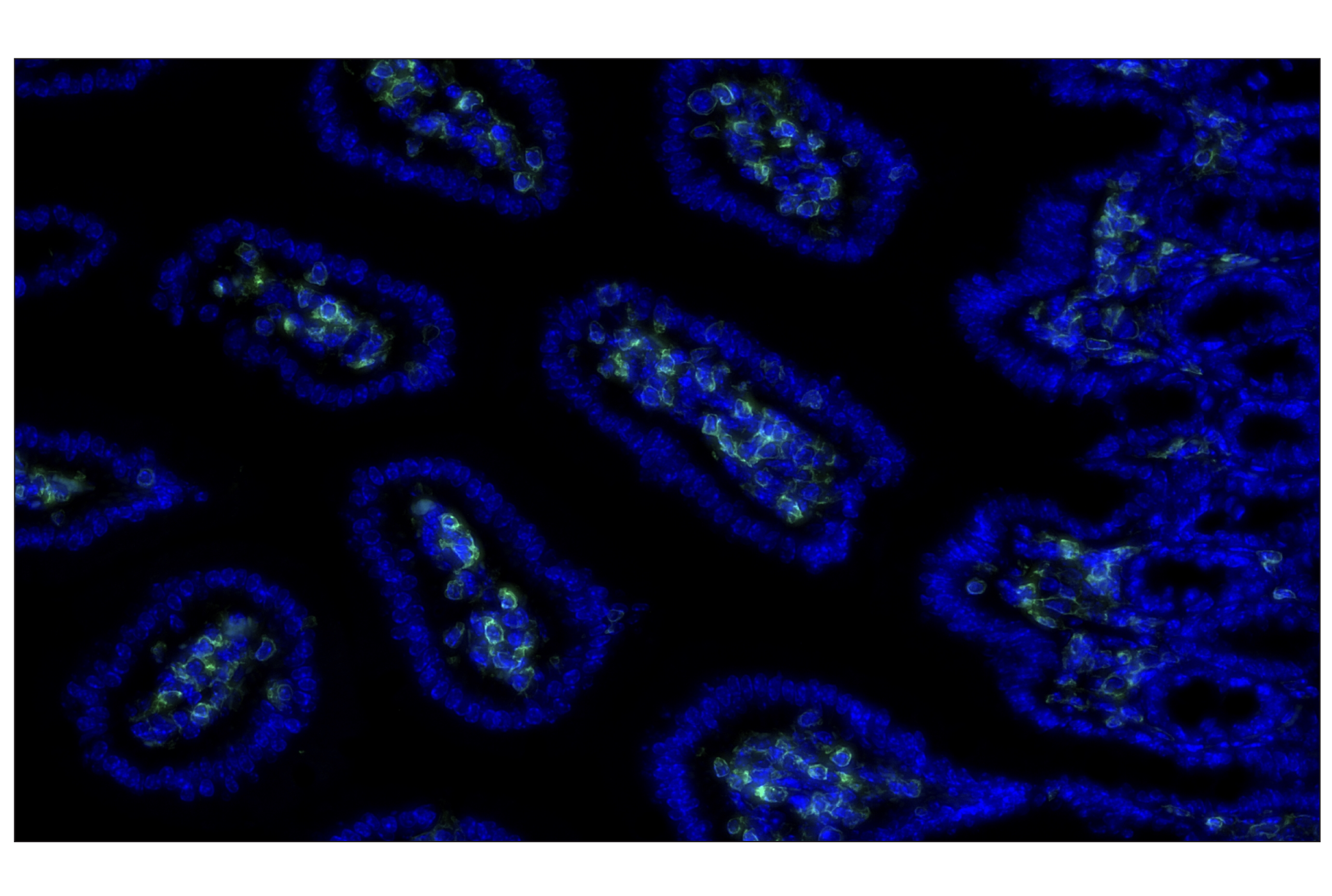 Immunohistochemistry Image 1: CD45 (D3F8Q) Rabbit mAb (Alexa Fluor® 488 Conjugate)