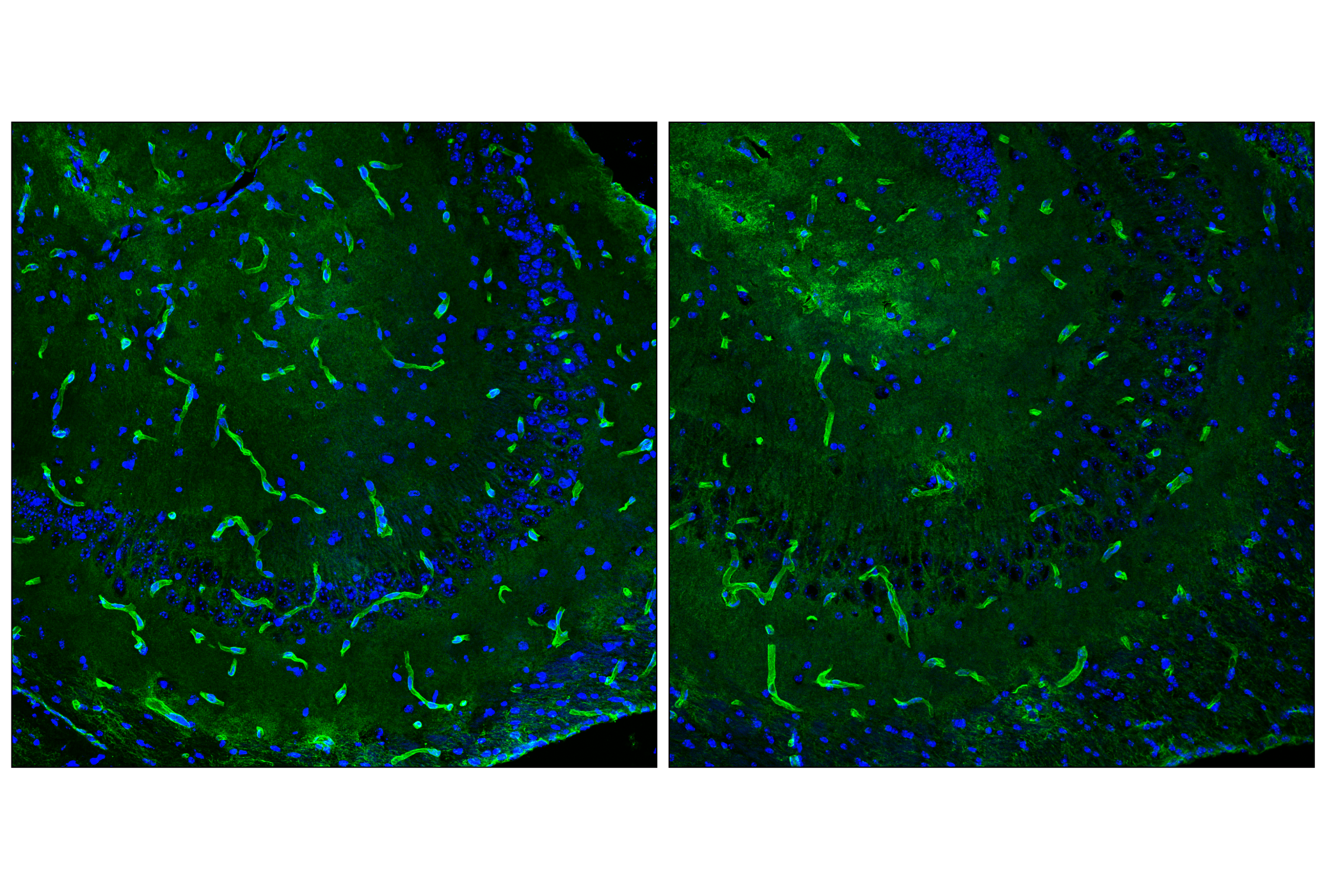 Immunofluorescence Image 1: AQP4 (D1F8E) XP® Rabbit mAb