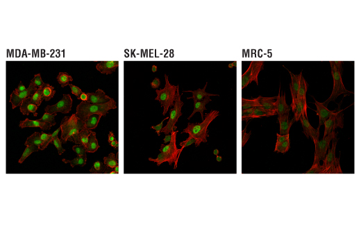 Immunofluorescence Image 1: TDP1 (D8D1B) Rabbit mAb