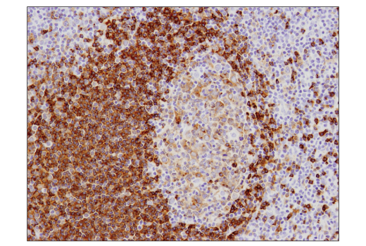 Immunohistochemistry Image 2: CD79B (D7V2F) Rabbit mAb (BSA and Azide Free)