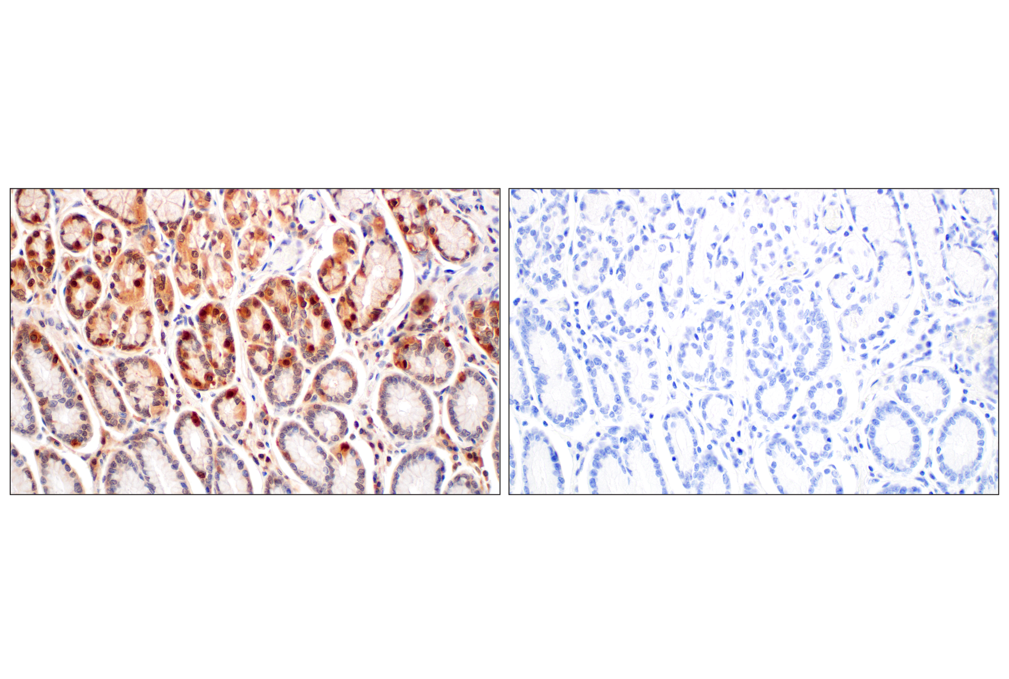 Immunohistochemistry Image 11: GPX4 (E5Y8K) Rabbit mAb