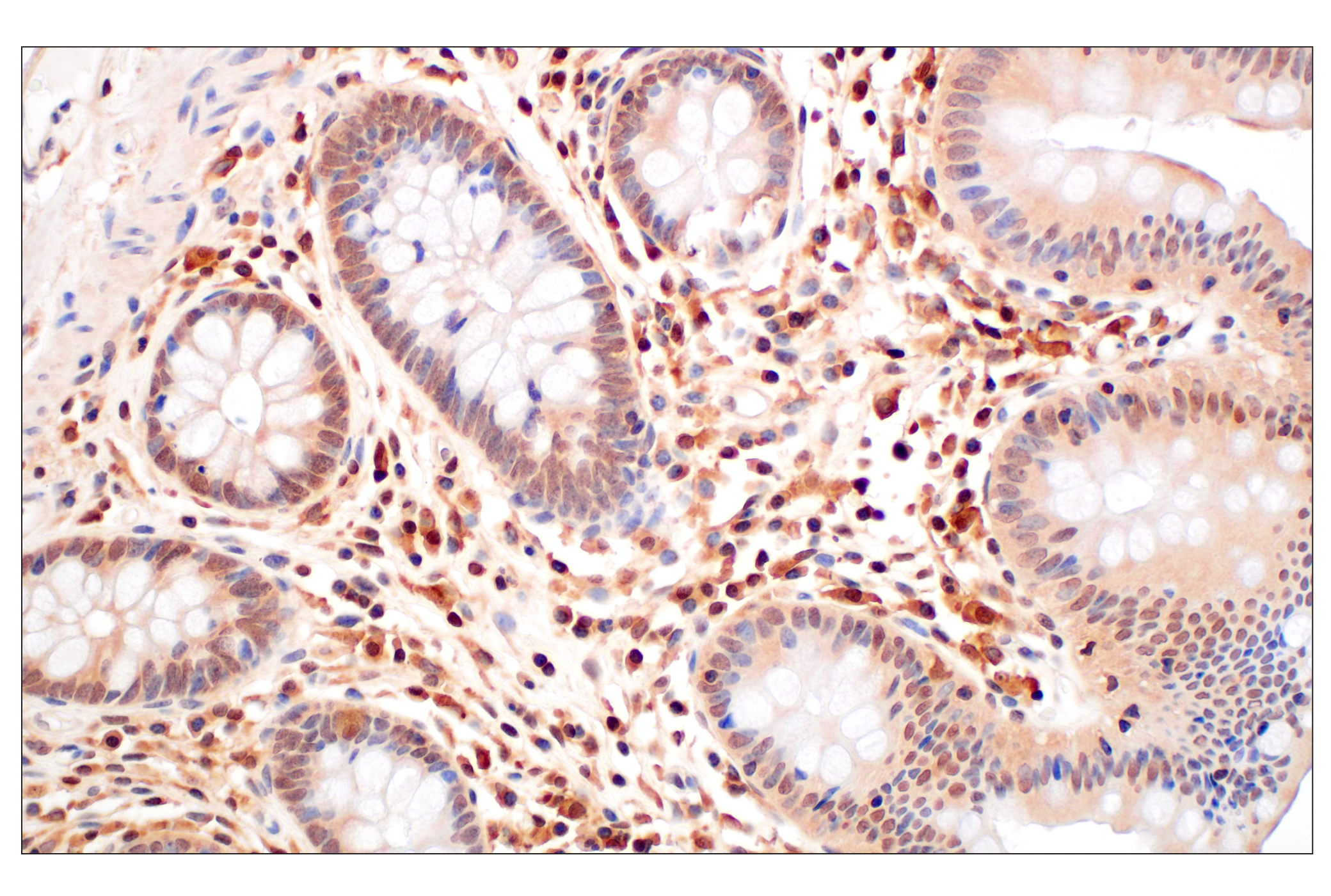 Immunohistochemistry Image 6: GPX4 (E5Y8K) Rabbit mAb