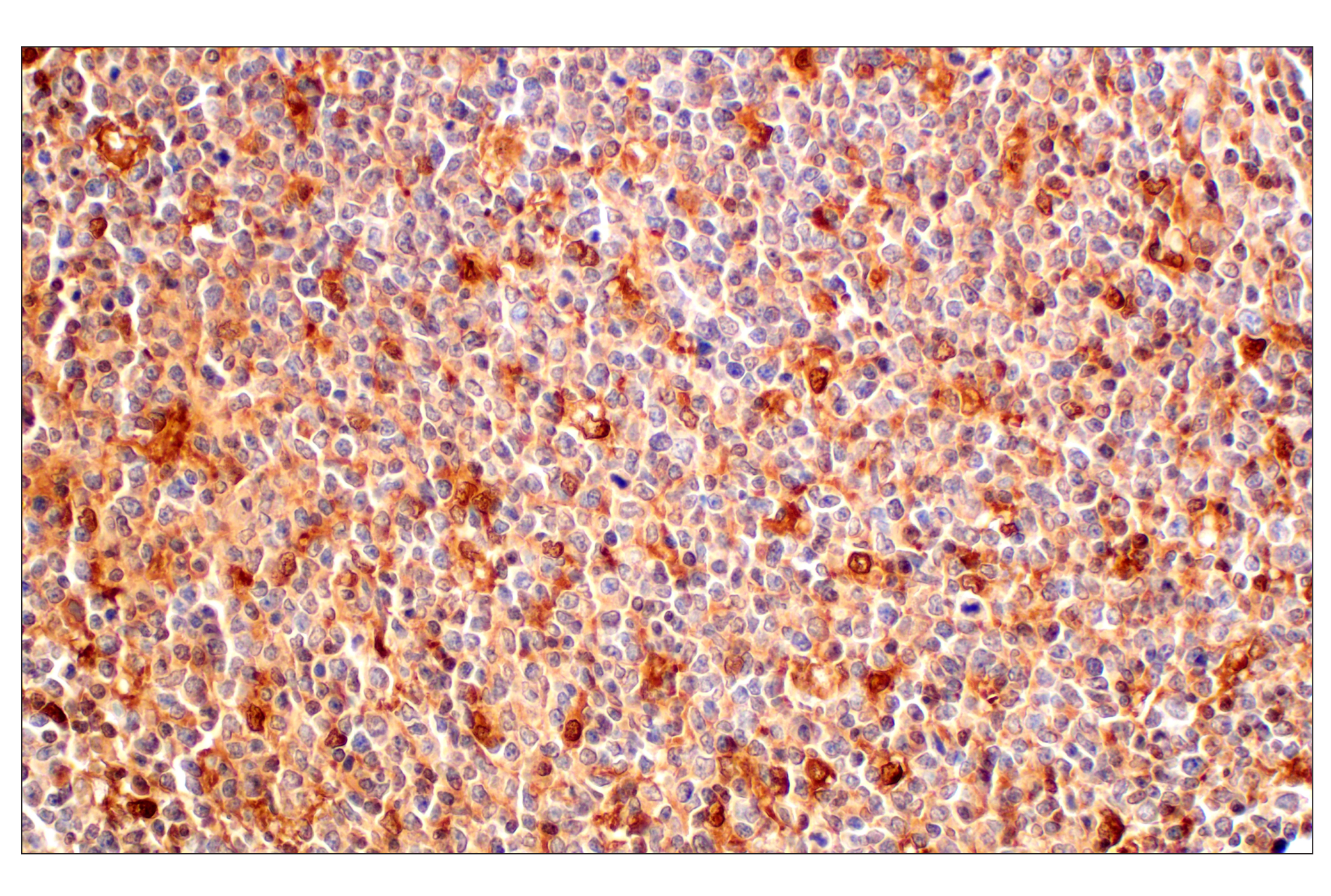 Immunohistochemistry Image 7: GPX4 (E5Y8K) Rabbit mAb