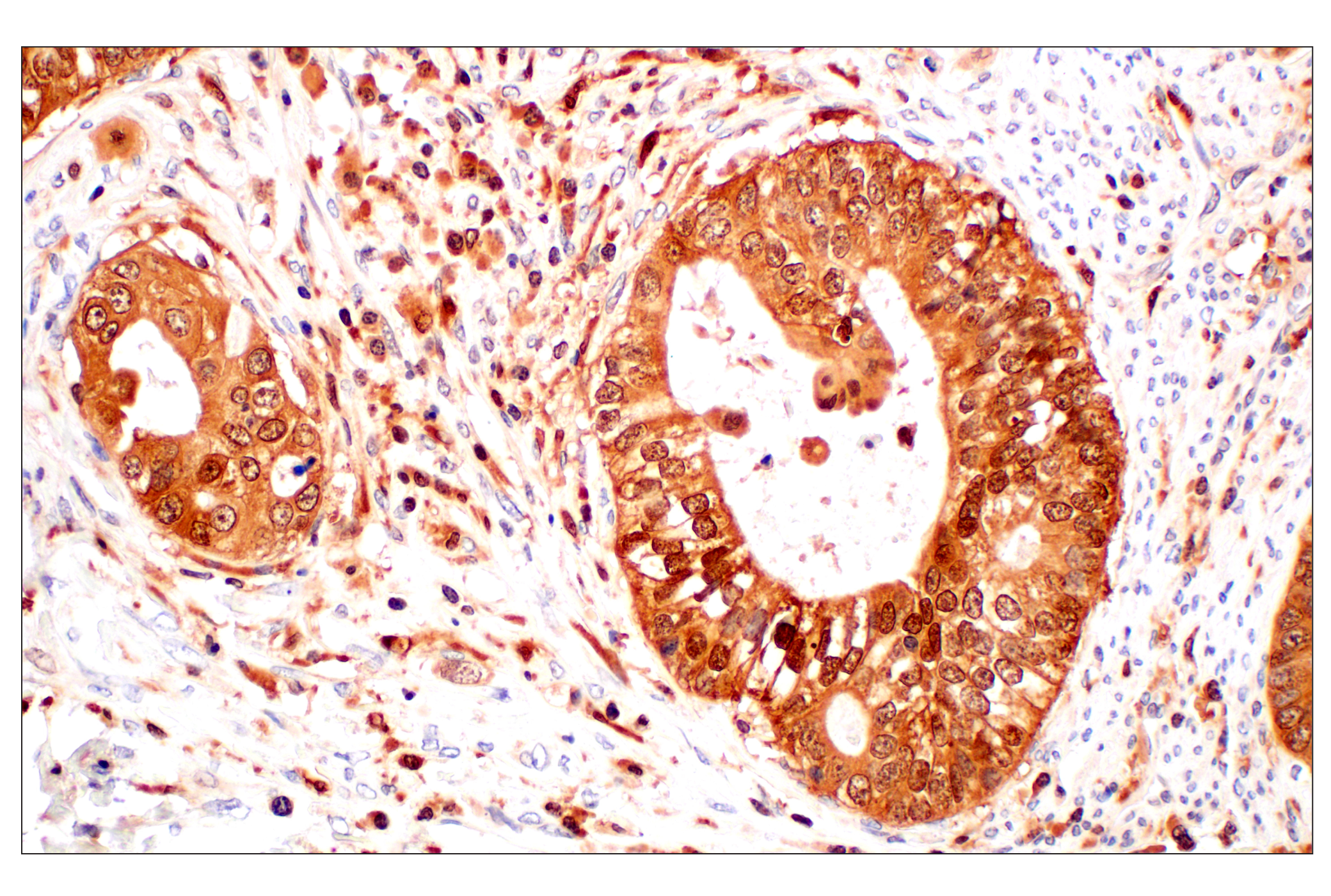 Immunohistochemistry Image 2: GPX4 (E5Y8K) Rabbit mAb