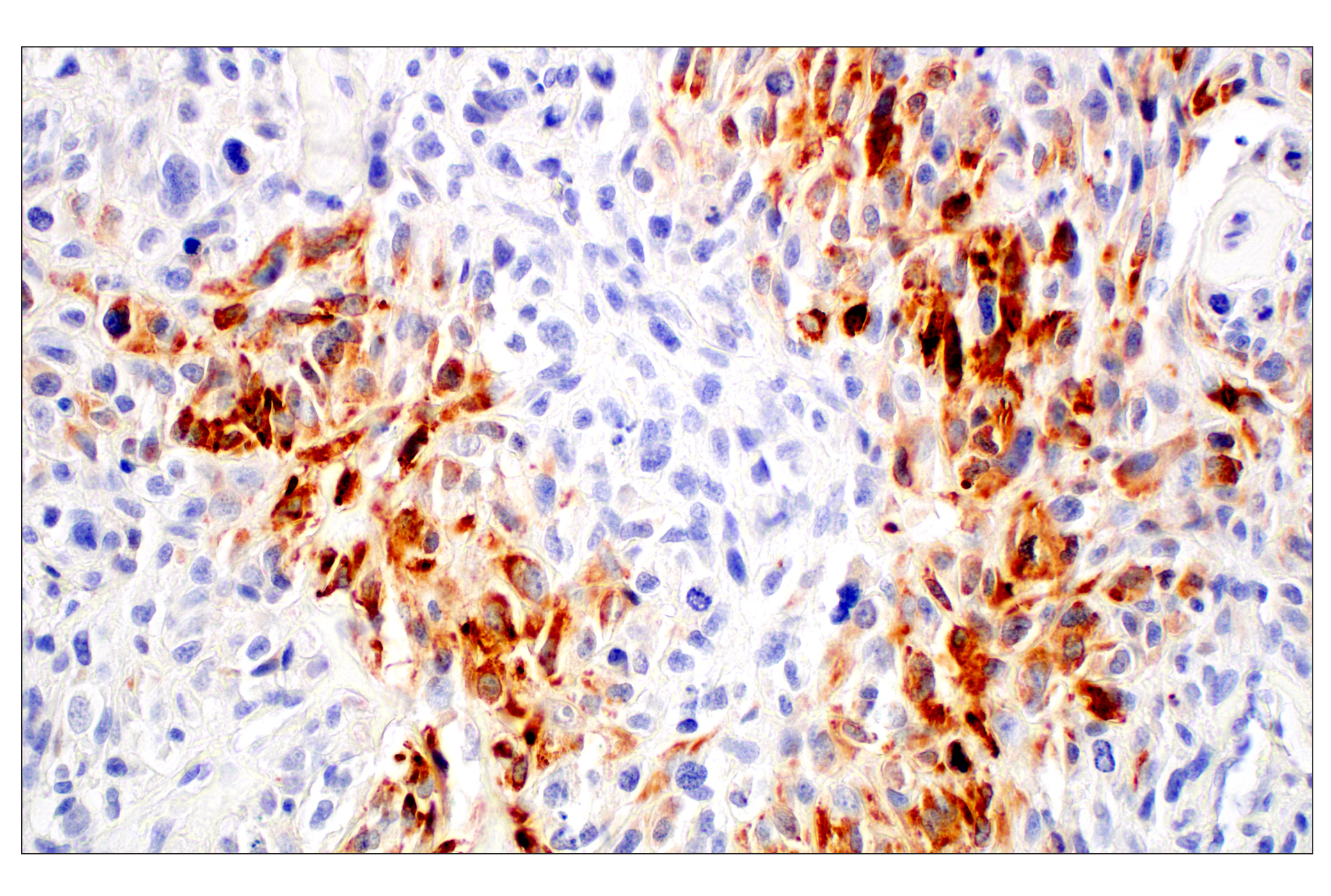 Immunohistochemistry Image 1: Osteocalcin (E8B9X) Rabbit mAb