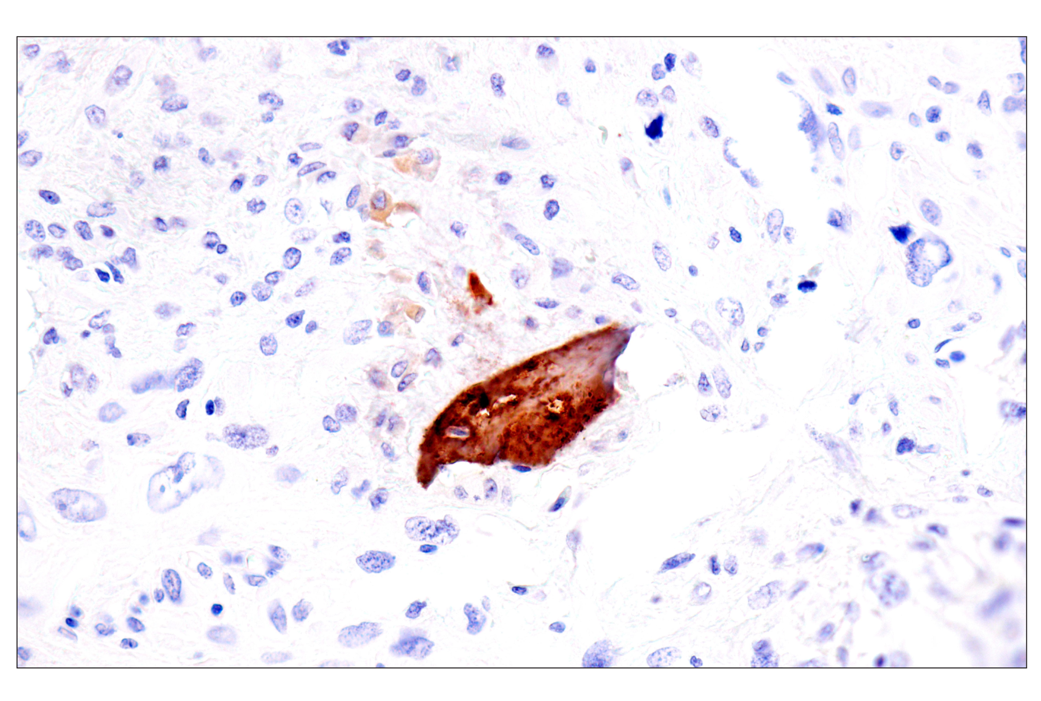 Immunohistochemistry Image 2: Osteocalcin (E8B9X) Rabbit mAb