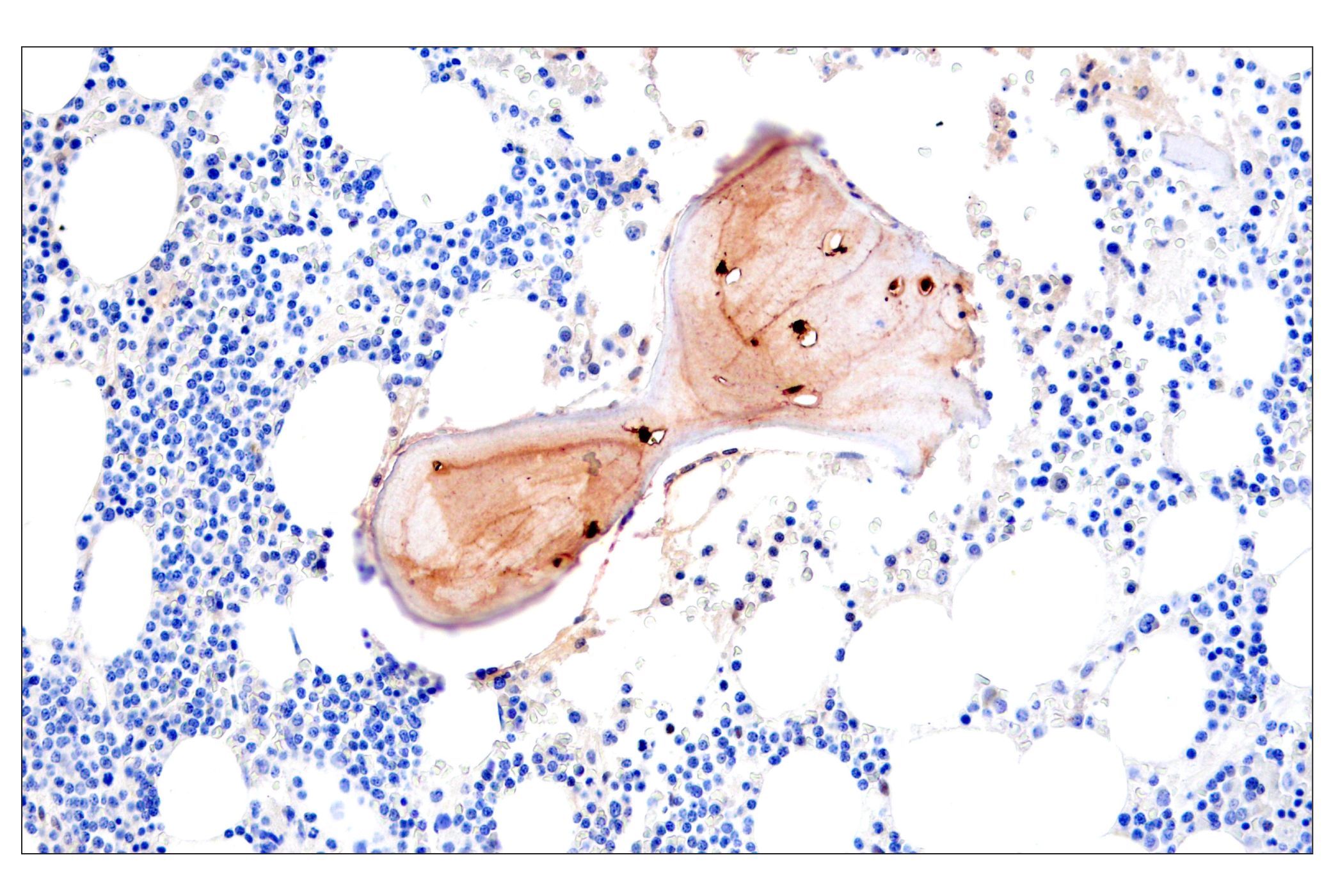 Immunohistochemistry Image 4: Osteocalcin (E8B9X) Rabbit mAb