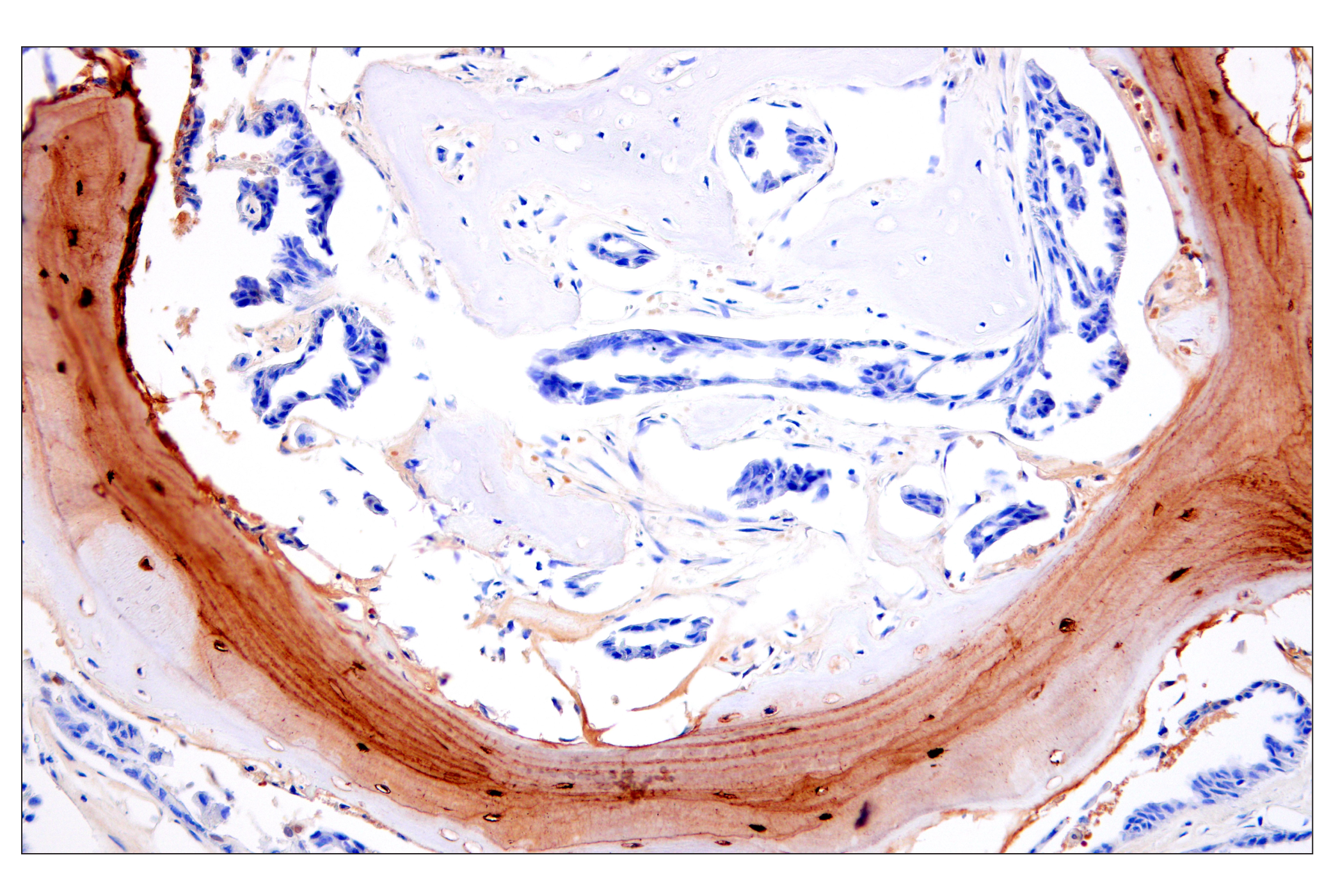 Immunohistochemistry Image 3: Osteocalcin (E8B9X) Rabbit mAb