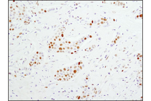 Immunohistochemistry Image 1: MCM4 (D3H6N) XP® Rabbit mAb (BSA and Azide Free)