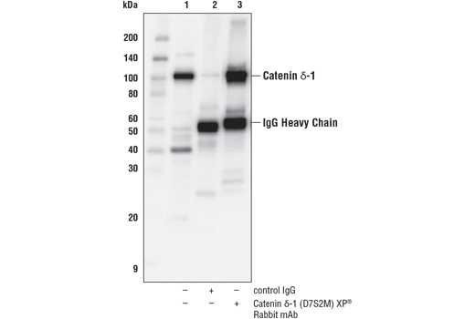 Immunoprecipitation Image 1: Catenin δ-1 (D7S2M) XP® Rabbit mAb