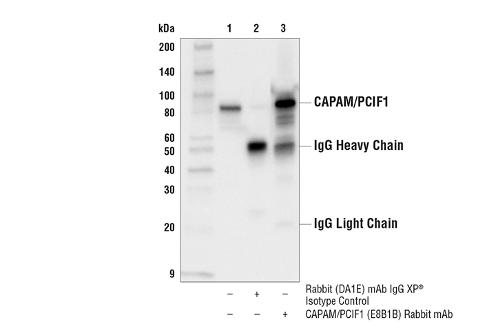 Immunoprecipitation Image 1: CAPAM/PCIF1 (E8B1B) Rabbit mAb