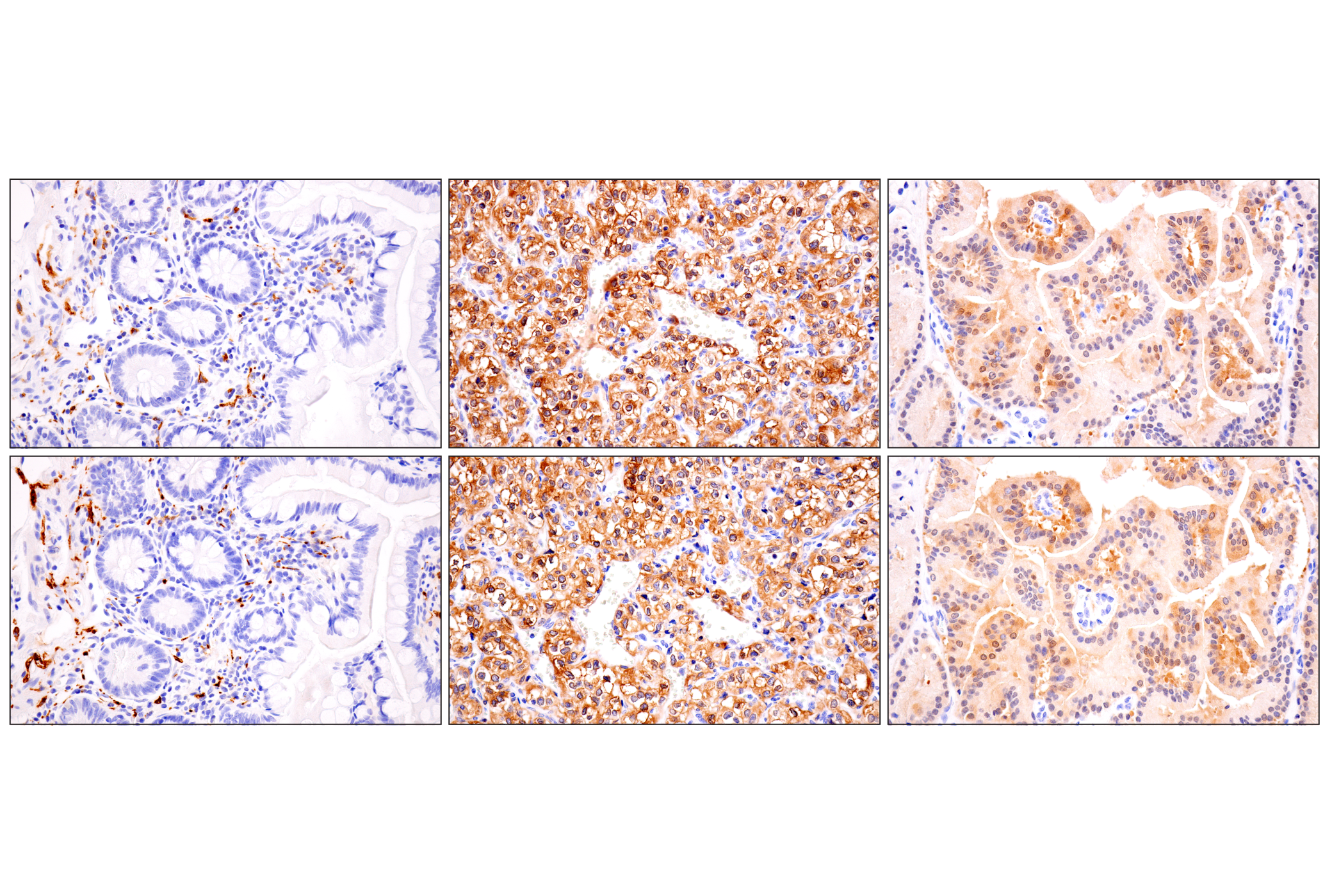 Immunohistochemistry Image 3: Phospho-Tau (Ser202) (F2A2F) Rabbit mAb