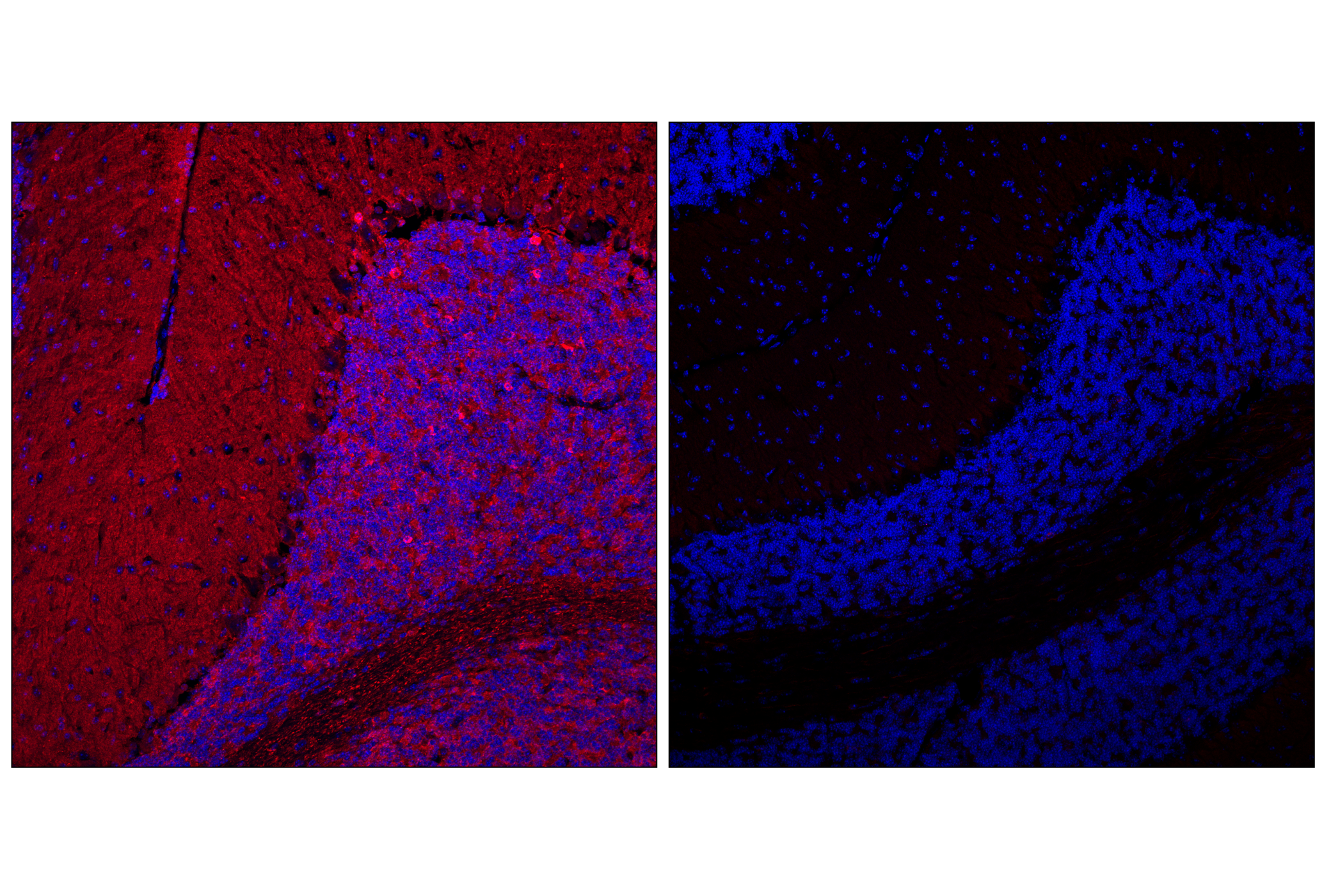 Immunofluorescence Image 1: Phospho-Tau (Ser202) (F2A2F) Rabbit mAb