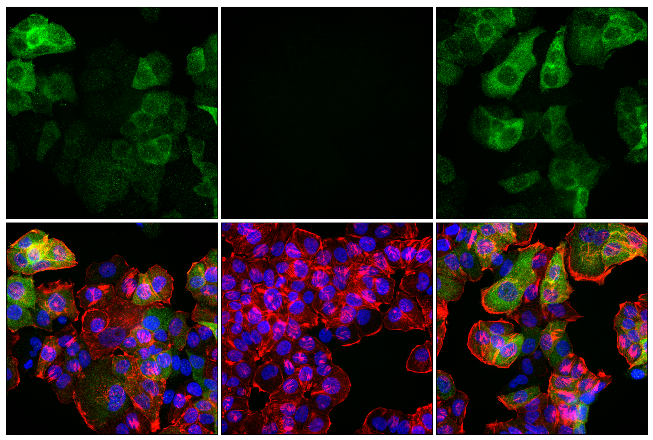 Immunofluorescence Image 4: Phospho-Tau (Ser202) (F2A2F) Rabbit mAb
