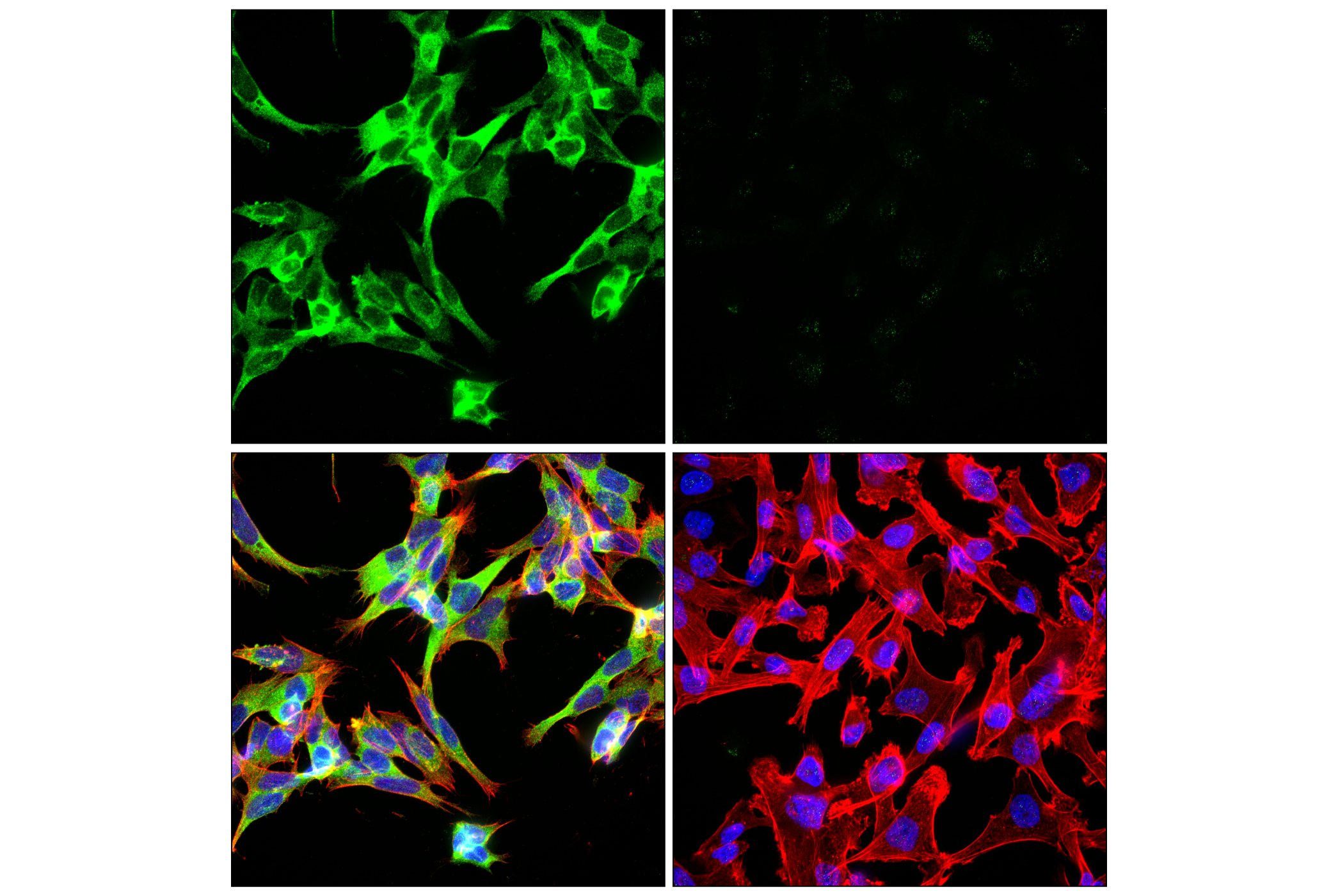 Immunofluorescence Image 3: Phospho-Tau (Ser202) (F2A2F) Rabbit mAb