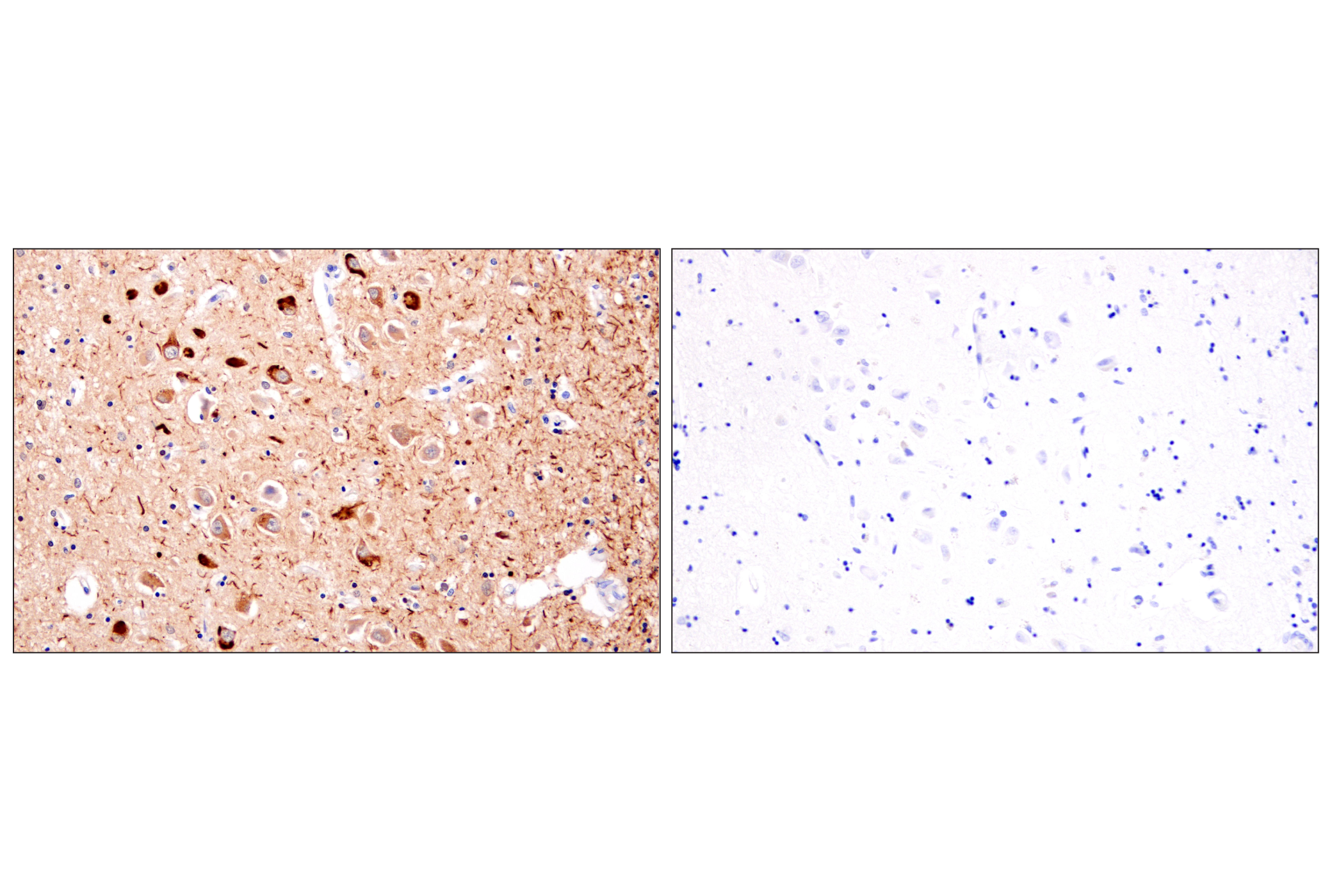 Immunohistochemistry Image 6: Phospho-Tau (Ser202) (F2A2F) Rabbit mAb