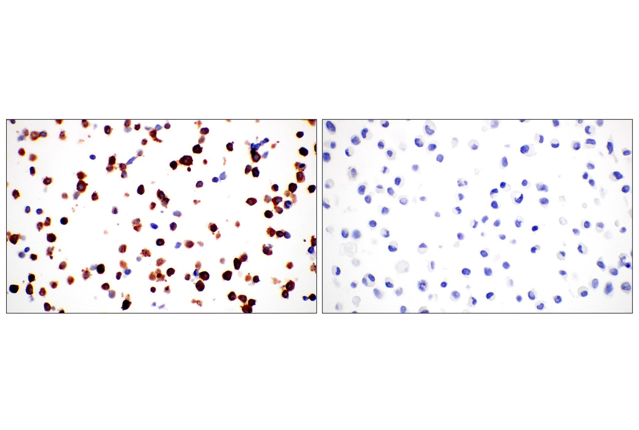 Immunohistochemistry Image 7: Phospho-Tau (Ser202) (F2A2F) Rabbit mAb