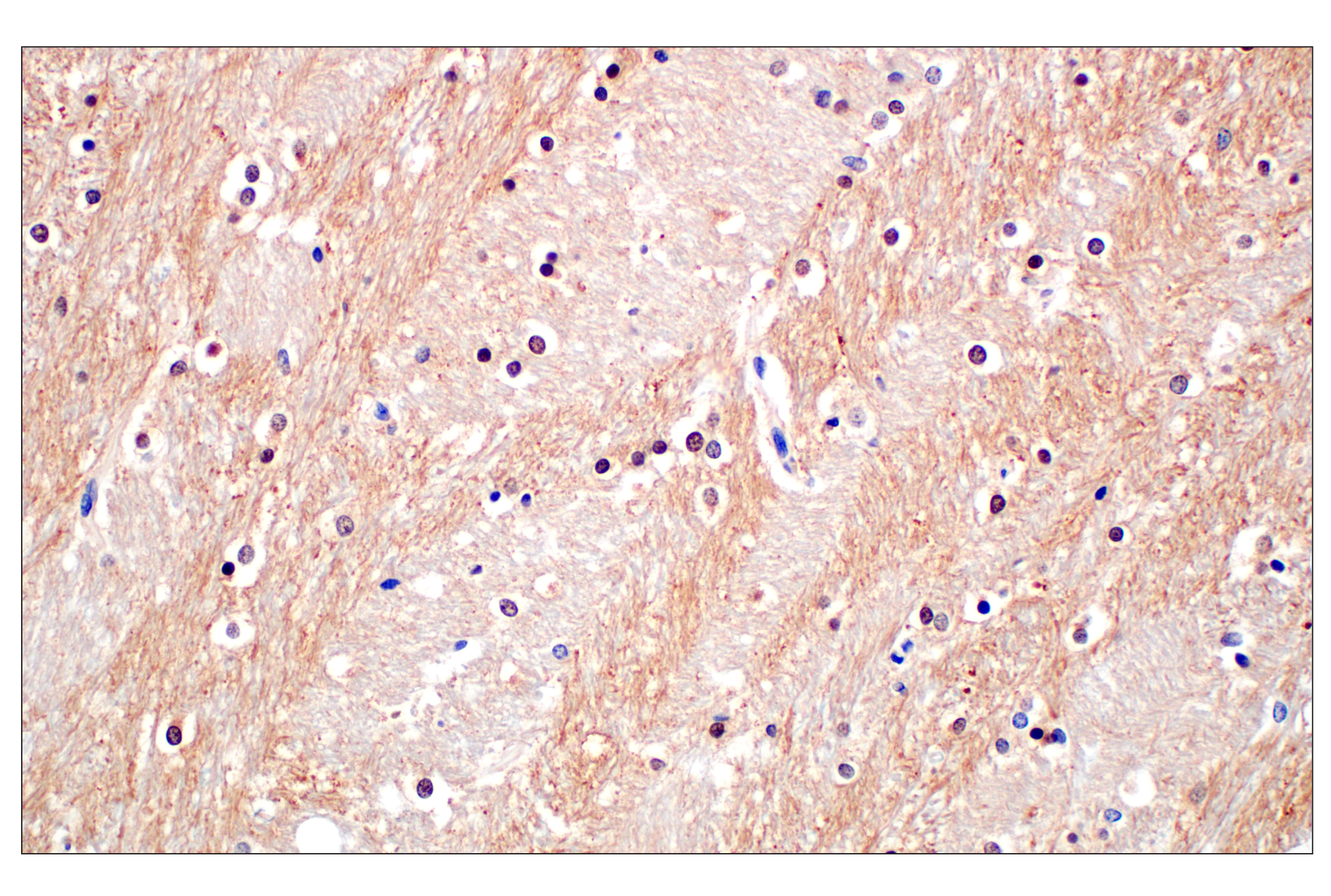 Immunohistochemistry Image 2: Phospho-Tau (Ser202) (F2A2F) Rabbit mAb