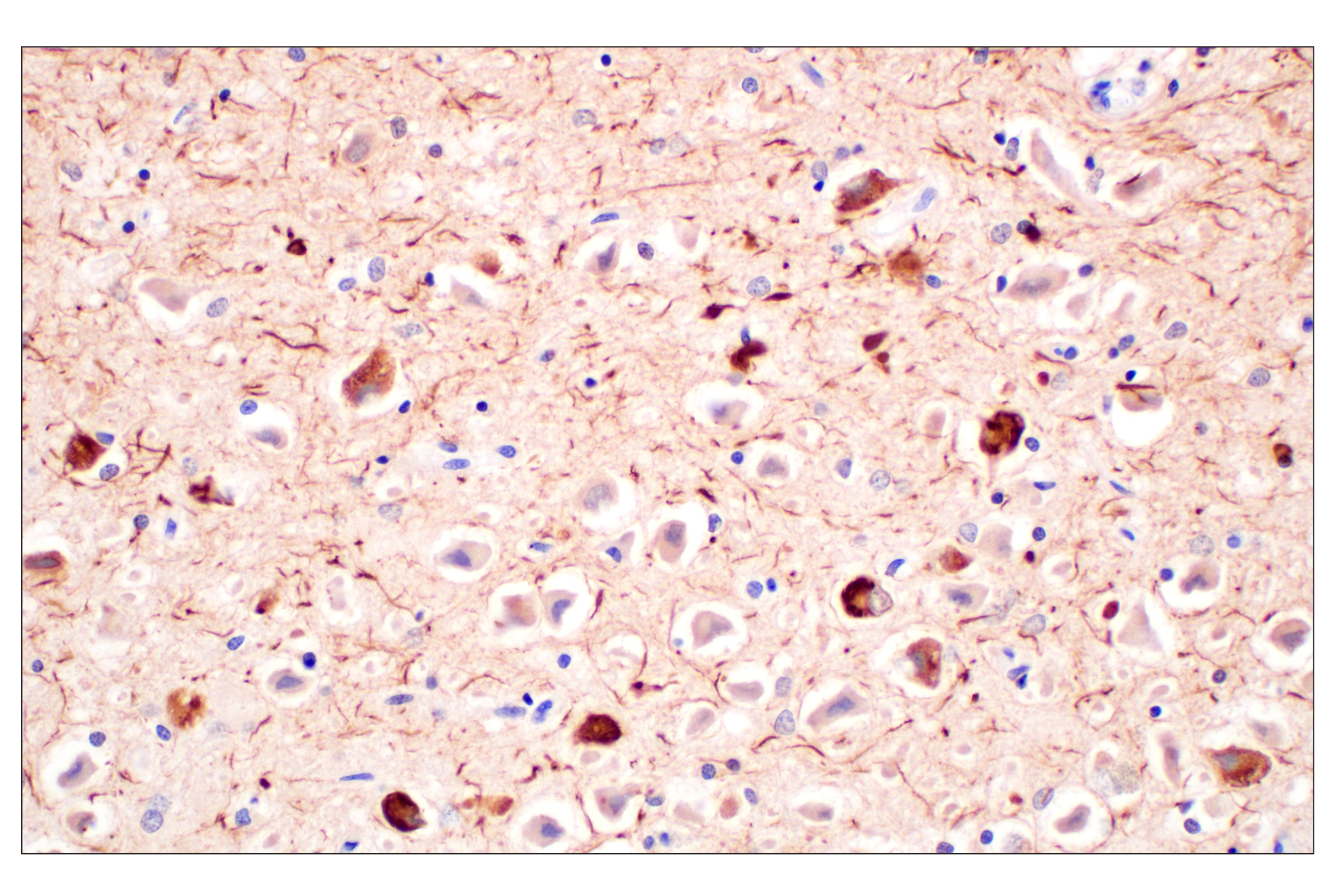 Immunohistochemistry Image 1: Phospho-Tau (Ser202) (F2A2F) Rabbit mAb