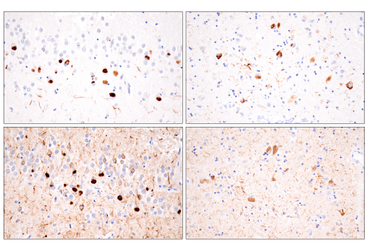 Immunohistochemistry Image 1: Tau (GT-38) Mouse mAb (BSA and Azide Free)