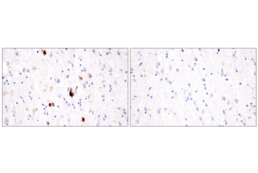 Immunohistochemistry Image 3: Tau (GT-38) Mouse mAb (BSA and Azide Free)