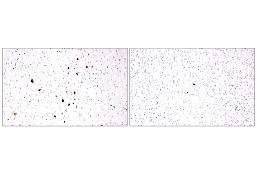 Immunohistochemistry Image 5: Tau (GT-38) Mouse mAb (BSA and Azide Free)