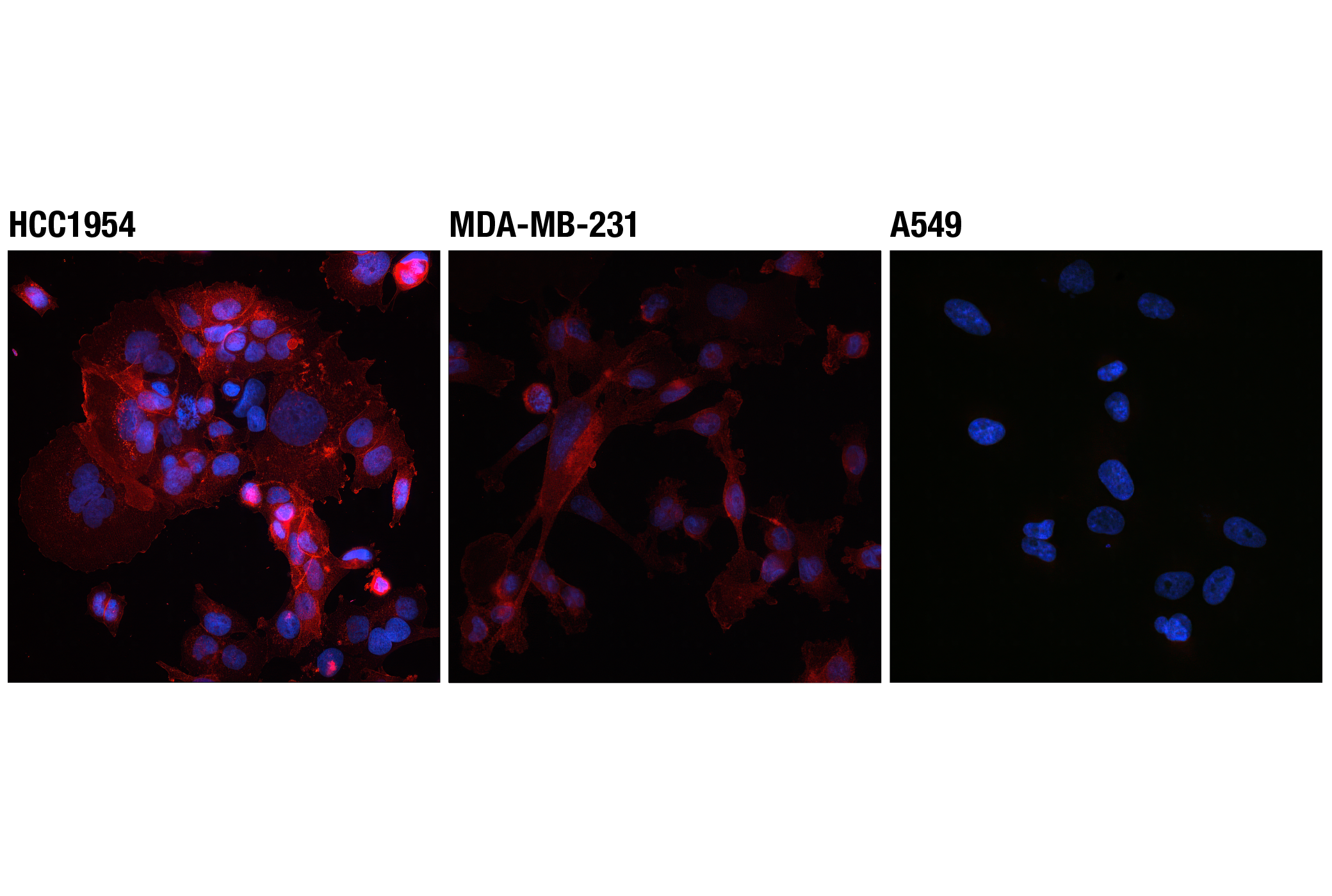 Immunofluorescence Image 1: PD-L1 (Extracellular Domain Specific) (D8T4X) Rabbit mAb (Alexa Fluor® 594 Conjugate)