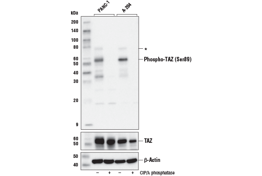  Image 6: Phospho-YAP/TAZ Antibody Sampler Kit