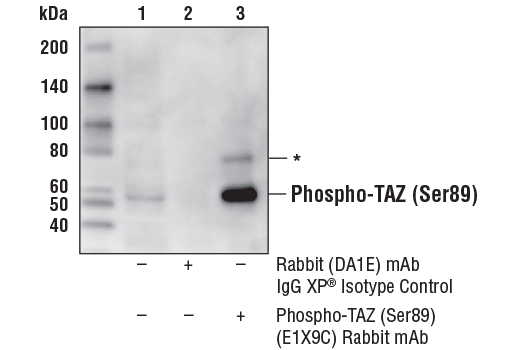  Image 14: Phospho-YAP/TAZ Antibody Sampler Kit