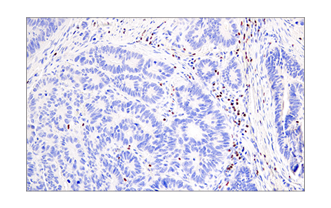 Immunohistochemistry Image 1: Helios (E4L5U) Rabbit mAb (BSA and Azide Free)