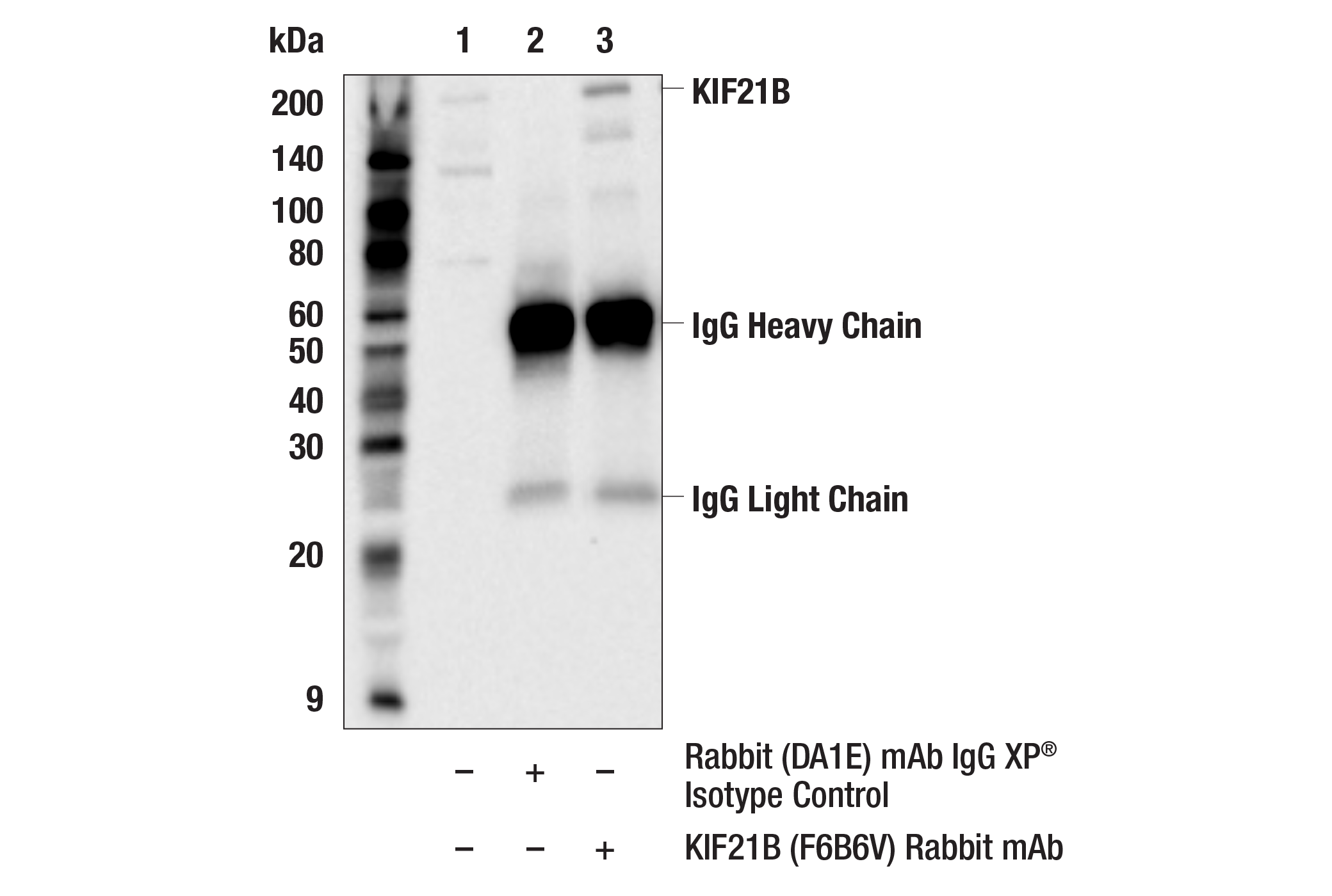 Immunoprecipitation Image 1: KIF21B (F6B6V) Rabbit mAb