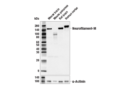 Western Blotting Image 1: Neurofilament-M (E7Y8W) Mouse mAb (BSA and Azide Free)