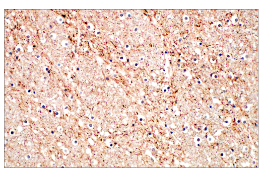 Immunohistochemistry Image 2: Neurofilament-M (E7Y8W) Mouse mAb (BSA and Azide Free)