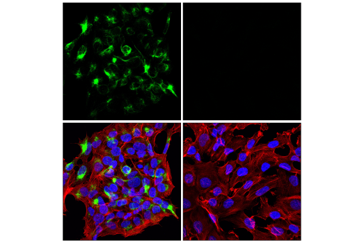 Immunofluorescence Image 2: Neurofilament-M (E7Y8W) Mouse mAb (BSA and Azide Free)