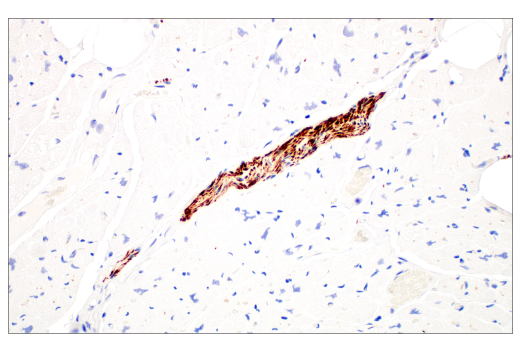 Immunohistochemistry Image 5: Neurofilament-M (E7Y8W) Mouse mAb (BSA and Azide Free)