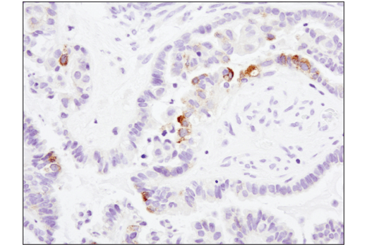 Immunohistochemistry Image 3: MUC5AC (E3O9I) XP® Rabbit mAb (BSA and Azide Free)