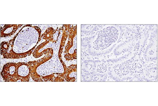 Immunohistochemistry Image 5: MUC5AC (E3O9I) XP® Rabbit mAb (BSA and Azide Free)